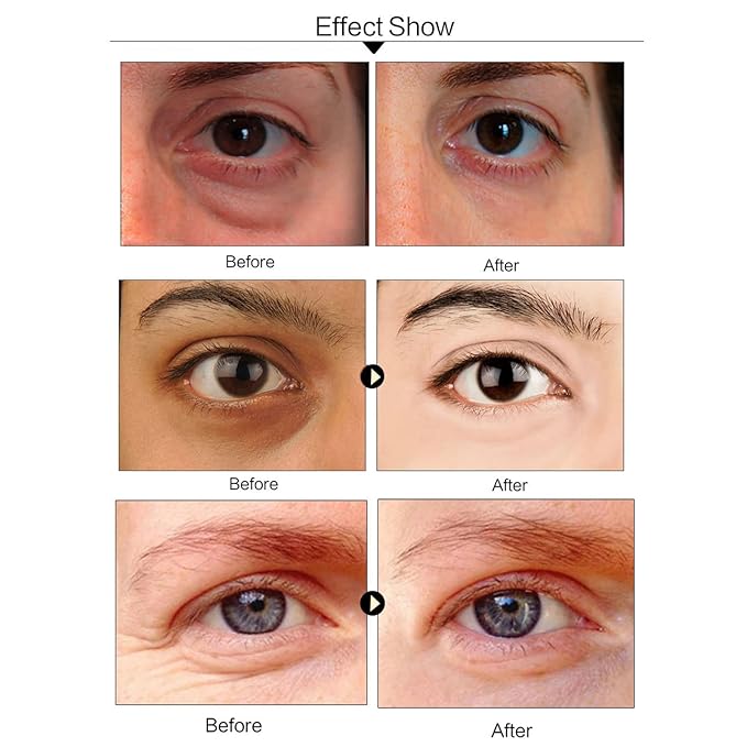 Under Eye Patches For Dark Circles, Aloe Vera Eye Mask For Puffiness, Hydrating Eye Gel Pads For Eye Bags And Wrinkles Under Eye Treatment, Improve And Firm Eye Skin Reduce Fine Lines - 30 Pairs