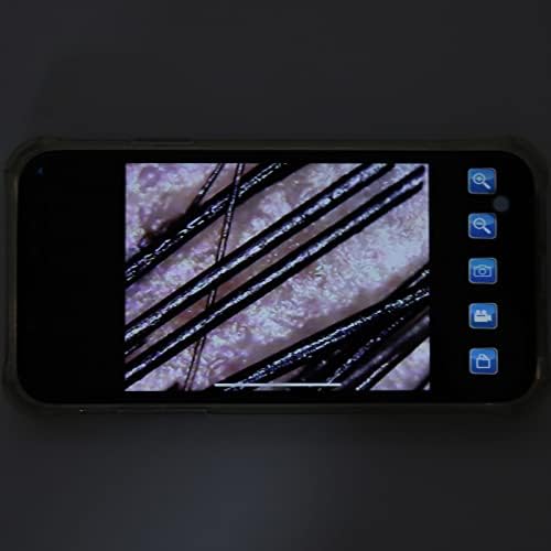 Connect 500X Scalp Detector for Hair Health, Skin Hair Diagnosis Analyzing High Definition Electronic Microscope Scalp Follicle Detector