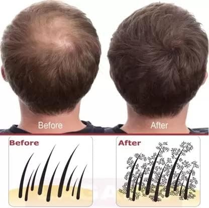 Hair Building Fiber Concealer, 28 gm (Natural Black)