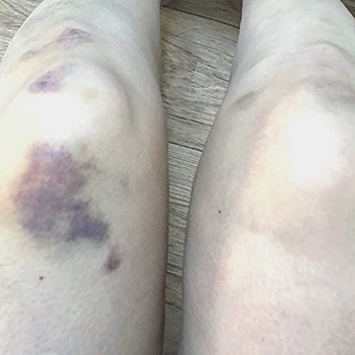 Cell Repair Cream Bruise Cream Bruise Relief Eye Twitch Facial Swelling Relief High Concentration of Ionized Magnesium 50ml