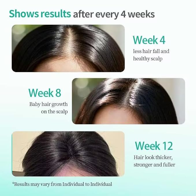 Rosemary Hair Oil, a lightweight rosemary essential oil spray, suitable for all scalps and hair, free of parabens and sulfate surfactants, 15ml. (3, 10.5ml)