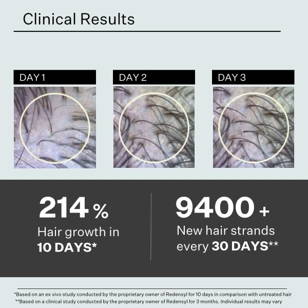 Multi-Peptide Serum for Men & Women - Helps Reduce Hair Loss - Strengthens & Thickens - Plant-Based - Combats Thinning Hair - Healthy Longer Hair - Root Awakening Morning (AM) - 28ml