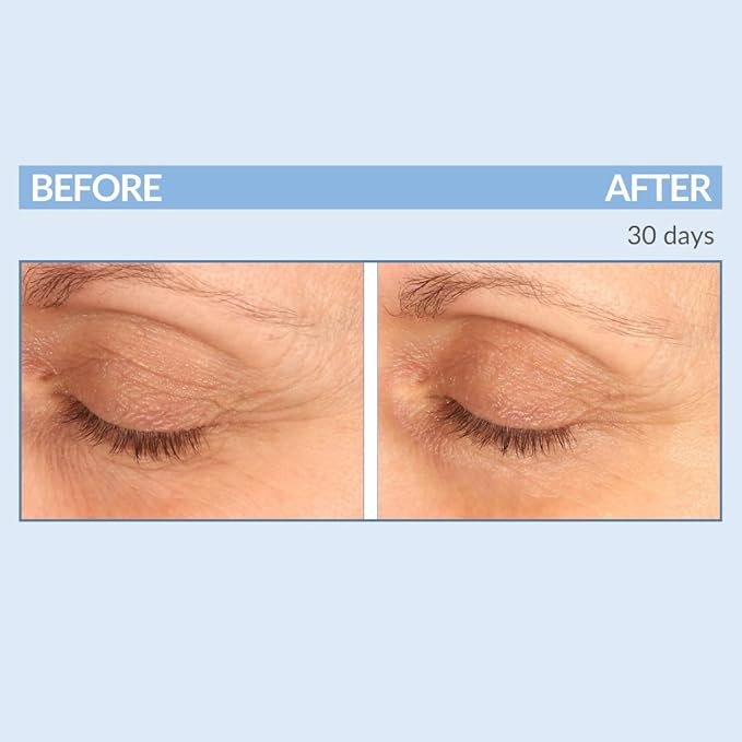 Serious Skincare - Eyetality PM Total Eye Care - Evening Night Eye Cream with Lash Boosting Peptides for Thicker, Longer Lashes - 0.5 oz.