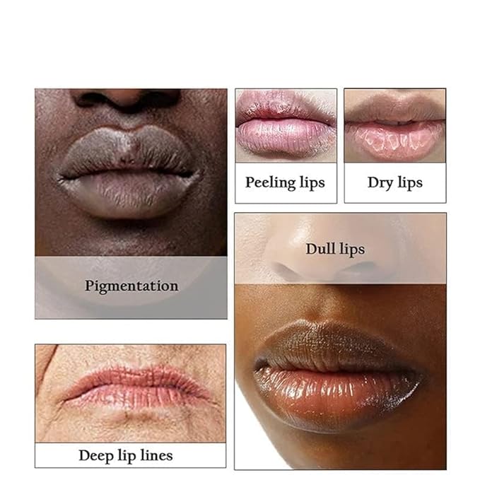2PC Lip Balm Fade Dark Pigment Whitening Moisturizing Lip Hyaluronic Acid Exfoliating Dead Skin Lightening Lip Care (Pink)