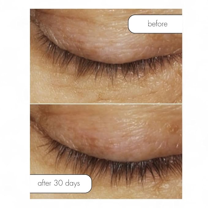 Serious Skincare Lash Bath & Conditioner - Double Action Eye Makeup Remover - Oil Free - Enhancing Peptides Promotes Eyelash Growth - Clover Flower - Effortlessly Removes Waterproof Mascara - 4 oz.