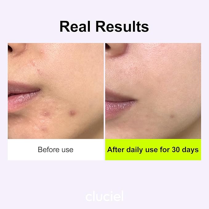 Niacinamide Peptide Serum I Repairing Serum, Targets Dullness, Dark Spots, Hyperpigmentation, Blemishes, Pore Care, Korean Glass skin (50ml / 1.69 fl.oz)