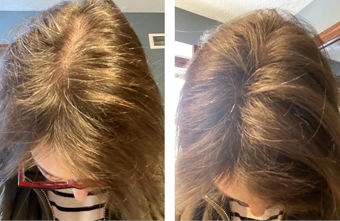 Cover Bald Spot and Thin Hair Instantly. Get 10X Fuller Hair With All-Natural, Plant-Based Hair Building Fiber (Trial Size, 10-Day Supply). Blonde