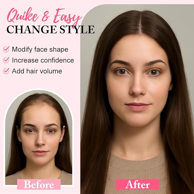 Hair Toppers for Women Real Human Hair Topper for Women with No Bangs Hairpieces Comfortable and Breathable 10 Inch Swiss Base 3D 360°Cover Glue-free and Shedding Free(Dark Brown)