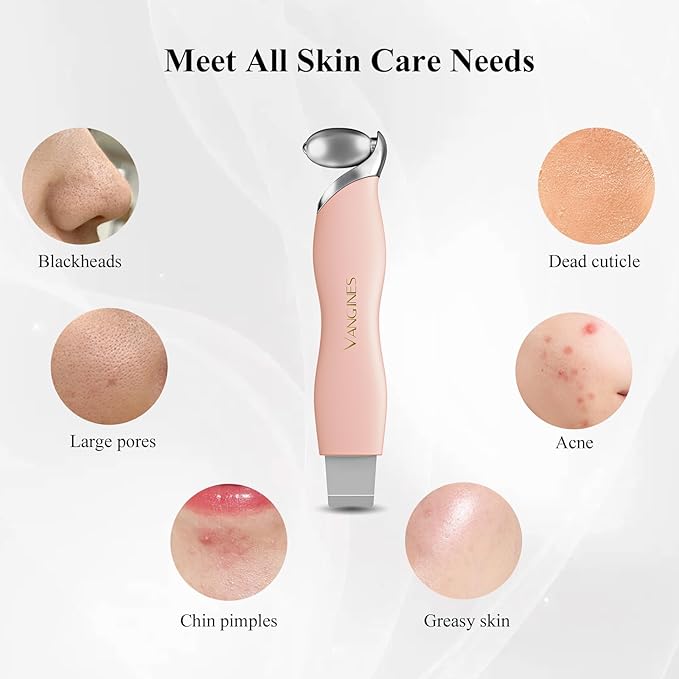 Blackhead Scraper Tool & Skin Scrubber Face Spatula for Blackhead Removal, Pore Cleaning, with Cooling Ice Roller & 2 Silicone Brush Heads (Dusty Rose)