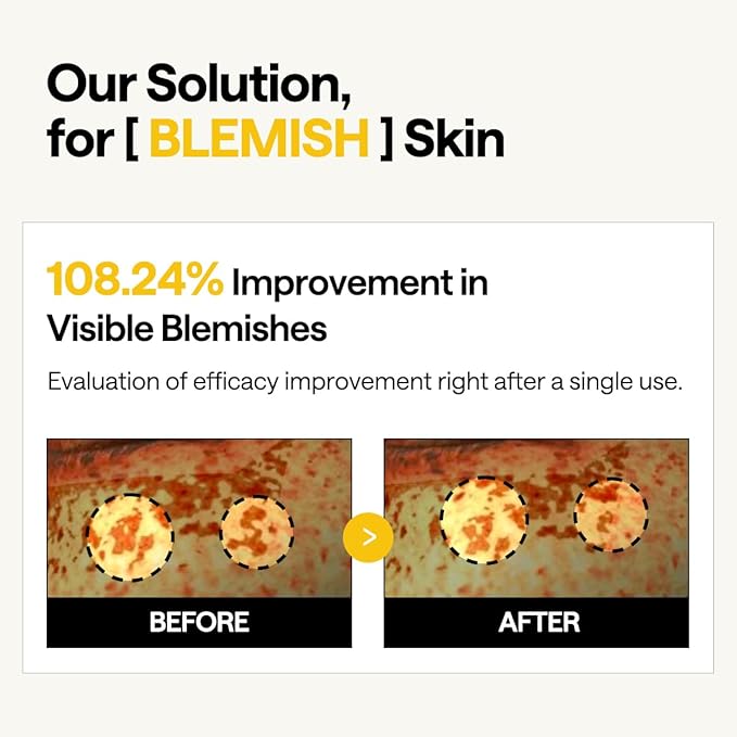 Mediheal Vita Collagen Under Eye Patches for - Korean Hydrogel Eye Pads (60 patches) with 7 Vitamin & 5 Micro Collagen. Moisturizng & Non Irritating Eye Gel Mask. Sealing Cap Included.