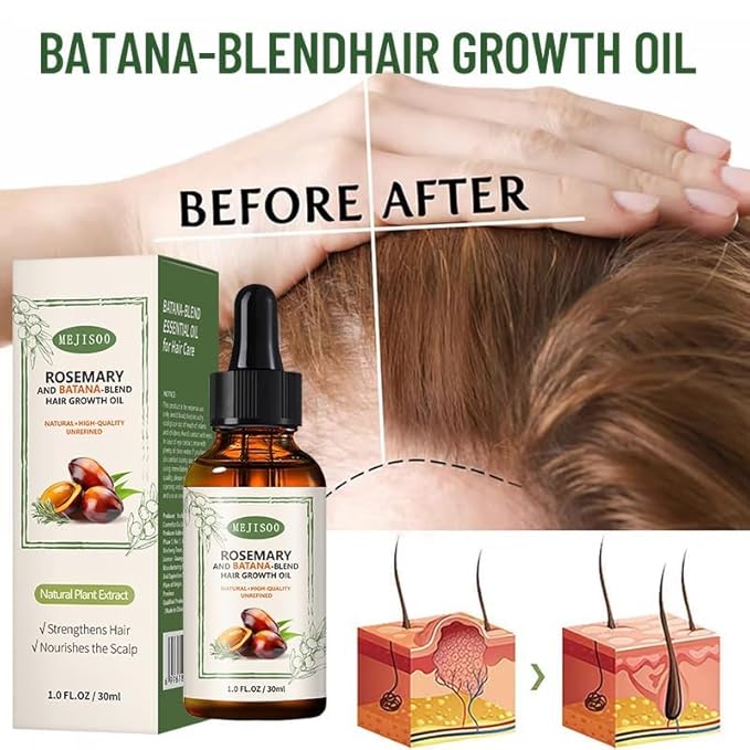 2 Pack Organic Batana Rosemary Oil for Hair Growth & Anti-Hair Loss, 2PCS 1 fl oz Natural DHT Blocker Scalp Treatment for Thinning Hair, Nourishing Dry Scalp & Strengthening Follicles