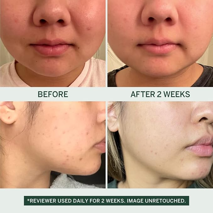 Urban Calm Collection Gift Set - Hydrating, Smoothing, Exfoliating, and Soothing Skincare Set for All Skin Types - Includes Fermented Skincare Products: Cleanser, Essence, Serum, and Cream