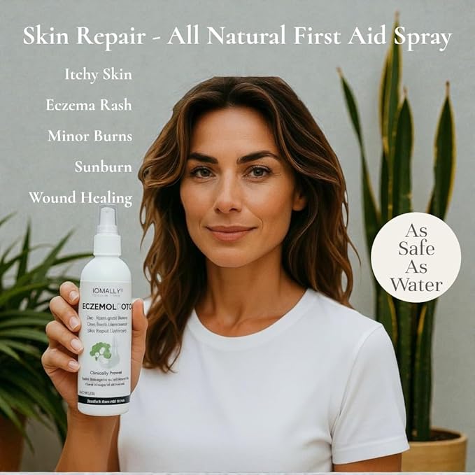 Loma Lux New Eczemol OTC Spray Natural & No Sting Hypochlorous for Eczema, Wounds, Burns, Cuts, Skin Irritation, Radiation Dermatitis, Sunburn, Itchy Skin, for Kids & Adults