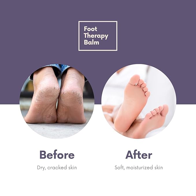 Victoria's Lavender Ultra Rich Foot Balm for Dry Cracked Feet – Heel Repair & Softener with Tea Tree Oil & Lavender – Dry Heels Treatment for Women & Men – Made in USA Foot Balm Stick - 2 Pack (2.5Oz)