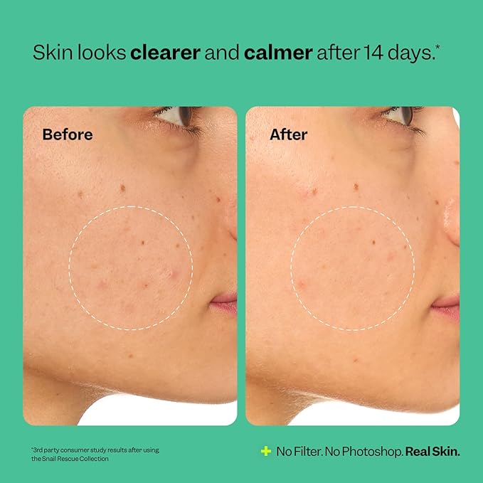 Peach Slices | Snail Rescue Intensive Treatment Wash-Off Face Mask | 95% Snail Mucin | For Dark Spots & Blemishes | Refreshing & Calming Mask | Clear, Radiant, & Hydrated Skin | Skin Care | 3.38 oz