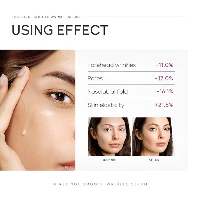 1% Retinol Serum for Face, Facial Serums for Anti Aging with Retinol, Niacinamide & Vitamin E for Fine Lines, Wrinkles & Dark Spots, Daily Skincare to Smooth & Firm Skin, 1.06 fl. oz, Pack of 2