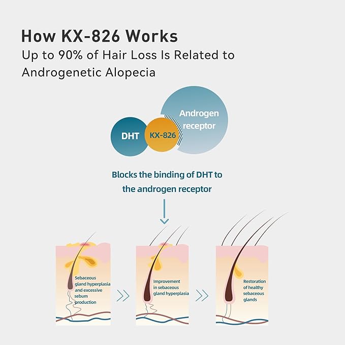 0.9% KX-826 KINTOR Hair Growth Spray,Strengthen Hair Nourish Hair follicles,Hair Care Products for Sparse Hair and Oily Hair Men&Women,60ml,Pro