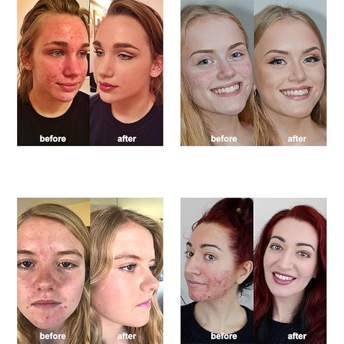 2 Pack PHOERA Foundation 103 Warm Peach Makeup,Full Coverage Foundation for Women and Girls