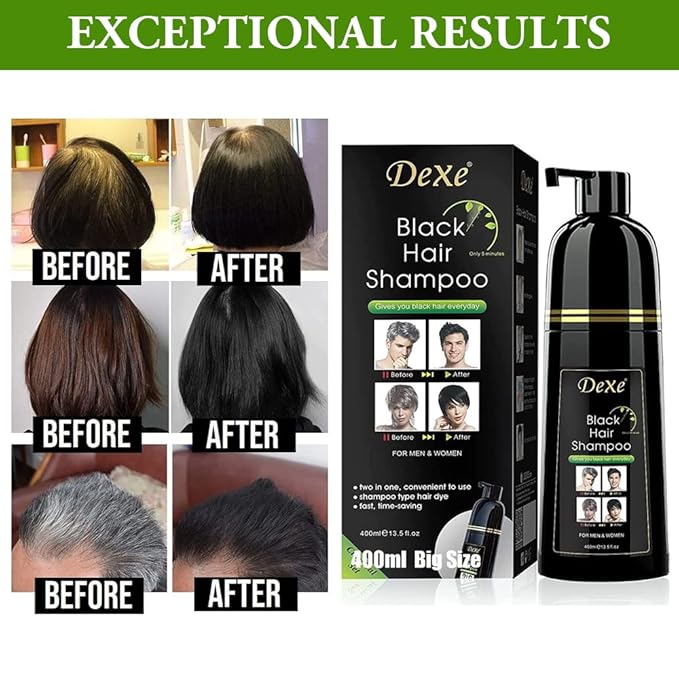 Dexe Hair Dye Shampoo 14.1 Fl Oz, Gray Hair Coverage, Black Hair Dye, Hair Color Shampoo, Black Hair Shampoo for Men & Women