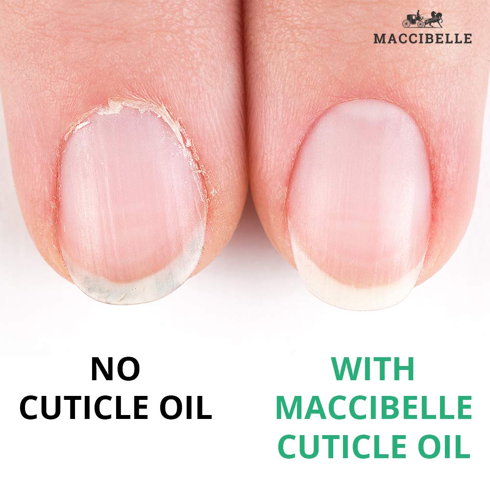 Maccibelle Cuticle Oil For Nails Refill size for Dry Cracked Cuticles (8 Ounce, Pineapple)