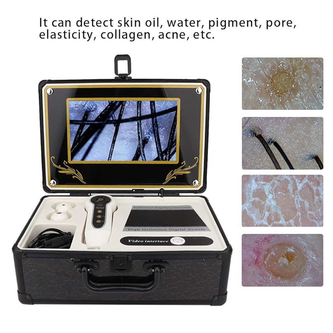 Skin Hair Scalp Detector, Skin Diagnosis Hair Analyzer 50X 200X Skin Hair Scalp Hair Follicle Detector Analyzers Microscope Skin Care Tool for Home Beauty Salon Spa