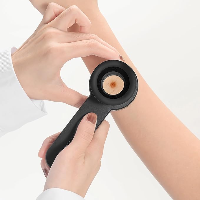 IBOOLO DE-3100 PRO Polarized No-Polarized and 365nm UV Light Dermatoscope, Handheld Portable Professional dermatoscopy