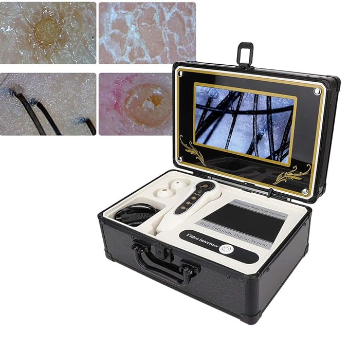Skin Hair Scalp Detector, Skin Diagnosis Hair Analyzer 50X 200X Skin Hair Scalp Hair Follicle Detector Analyzers Microscope Skin Care Tool for Home Beauty Salon Spa