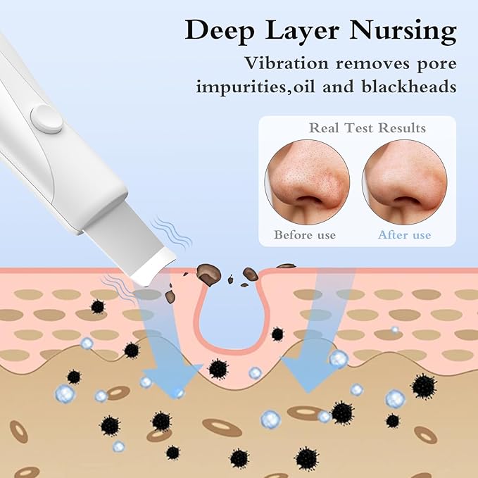 Skin Scrubber Face Spatula Skin Spatula Pore Cleaner Blackhead Remover Tools for Facial Deep Cleansing Skin Care Tool for Men and Women (White)