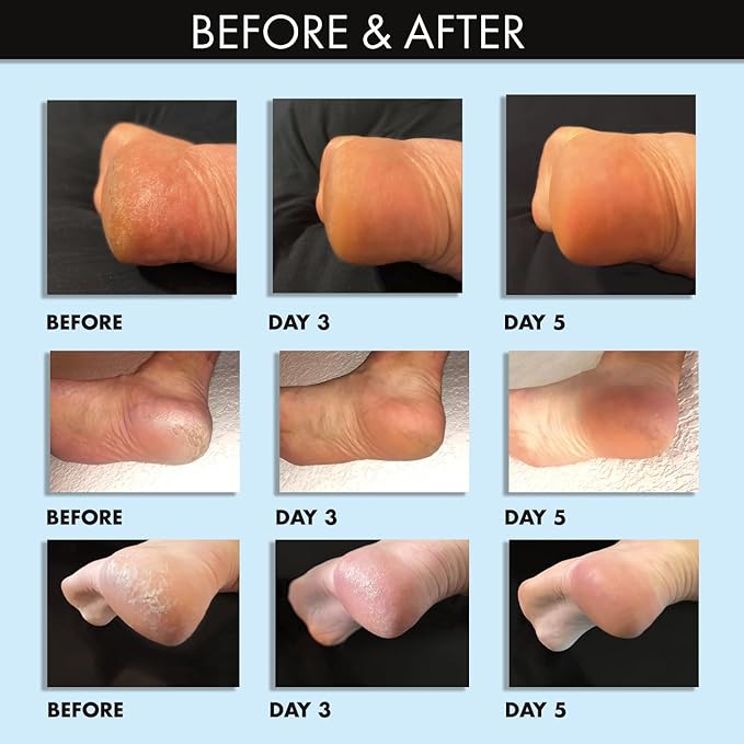 Whish Coconut Milk + Verbena Exfoliating Foot Mask - Smoothes & Softens, Intense Hydration