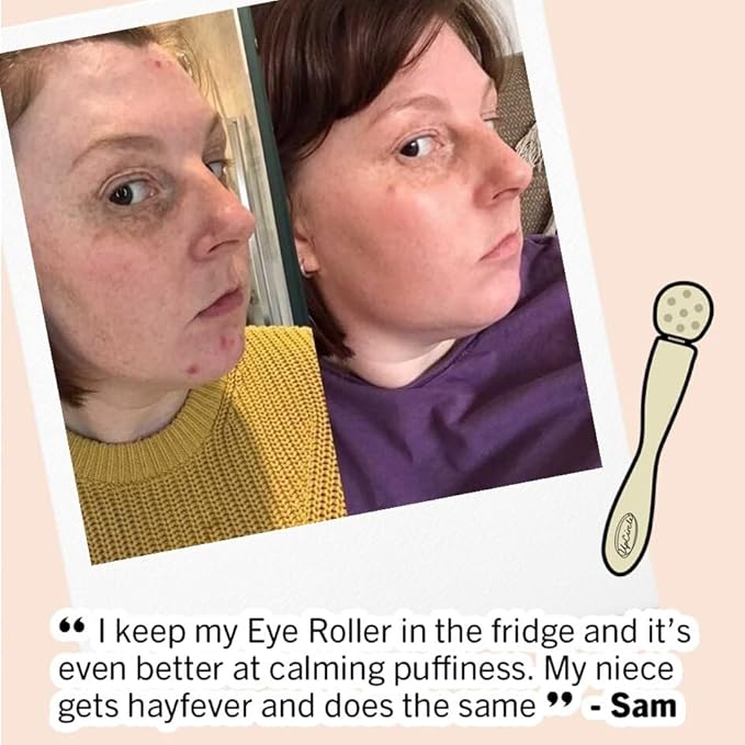 UpCircle Eye Roller 1pc – Metal + Plastic-Free – For Dark Circles + Puffy Eyes – With Cooling Effect to Boost Circulation For Healthy Glow – Sustainable + Unisex