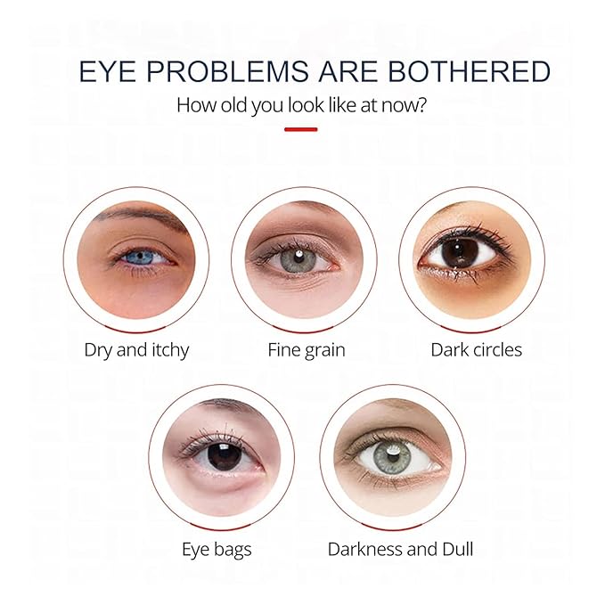 Open eyes awaken peptide lifting eye gel,peptide eye lifting gel,Reduces Dark Circles, Dark circles Hydrating firming Eye cream (2PCS)