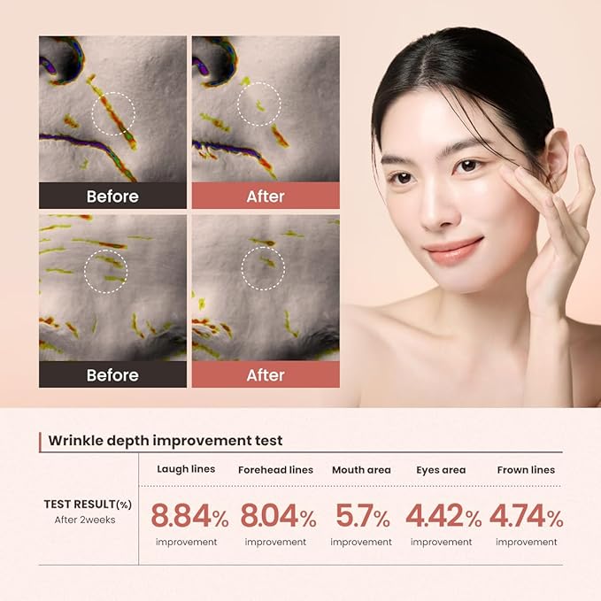 Lifting Serum – 30ml (1.01 fl oz) – Visibly Firms Skin, Reduces Wrinkles, Tightens Pores, Deep Hydration with Peptides & Caffeine