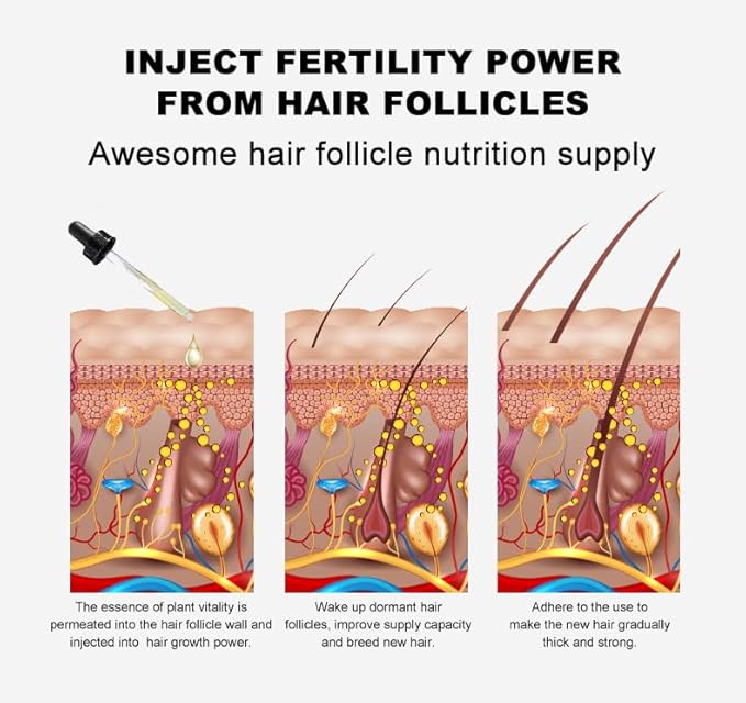 Vedora King of Ginger Oil for Hair Growth - Biotin Hair Growth Serum, 100% Pure Natural Ginger Essential Oil - Promotes Stronger, Thicker, Longer Hair in Women & Men - 3.15 Fl Oz / 90ML (3 PCS)