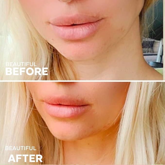 Three Ships Buttercream Hydrating Lip Mask – Intensive Vegan Lip Moisturizer – As Seen on TV – Soothing, Natural Lip Conditioner Treatment for Dry, Damaged Lips, 15g