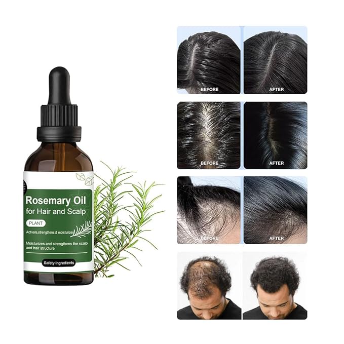 2 Pack Rosemary Oil for Hair and Scalp,Women Men Natural Rosemary Hairs Essential Oils for Nourishing Scalp,Promoting Hair Thickness,Strengthening and Improving Dry Damaged Hair,1.7 Fl oz