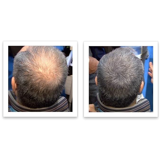 Trial Size - Make Thin Hair Look 10X Fuller. Eliminate Bald Spot and Thinning Hair Instantly. All-Natural Hair Concealer. Salt & Pepper - Light