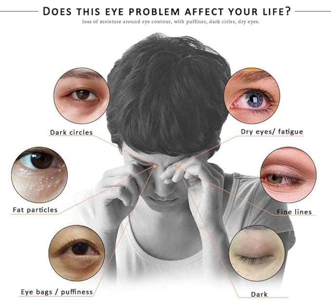 Eye Peptide Serum Eye Massage Roller Nourishing Relieve Loose Eye Bags Dark Circles Eye Skin Care Under Eye Cream for Fine Wrinkles and Puffiness Daily Skincare(Nourishing Grey)