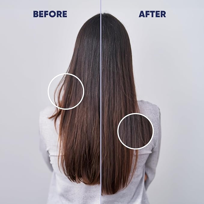 MOERIE Ultimate Hair Growth Serum for Natural Hair Regrowth & Thickening - Anti Thinning & Hair Loss Treatment for Women - Rapid Hair Growth Products (1.69 Fl Oz (Pack of 3))