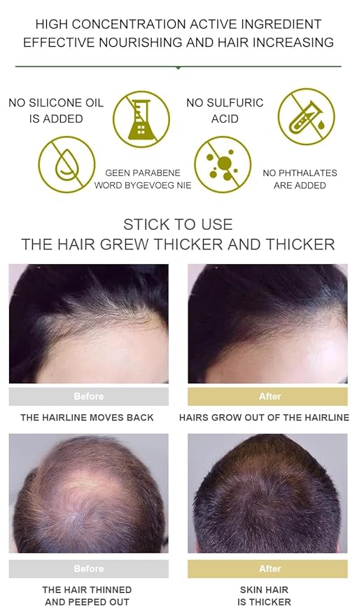 Vedora Ginger Oil for Hair Growth - Biotin Hair Growth Serum, 100% Pure Natural Ginger Essential Oil - Promotes Stronger, Thicker, Longer Hair in Women & Men - 3.0 Fl Oz / 90ML (3pc+Roller)