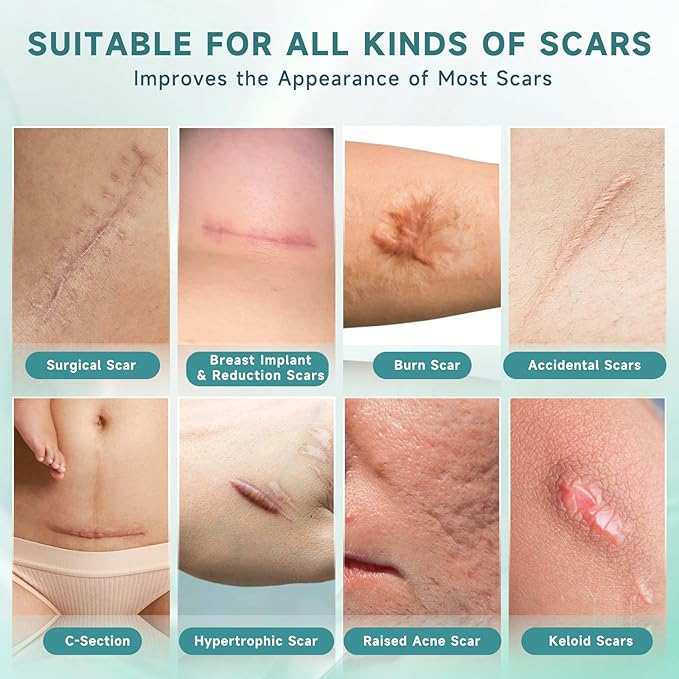 Scar Suite Bundle, Advanced Silicone Scar Cream and Scar Sheets, Advanced Scar Treatment for Surgery, Burns, and Injuries, Professional Grade Results