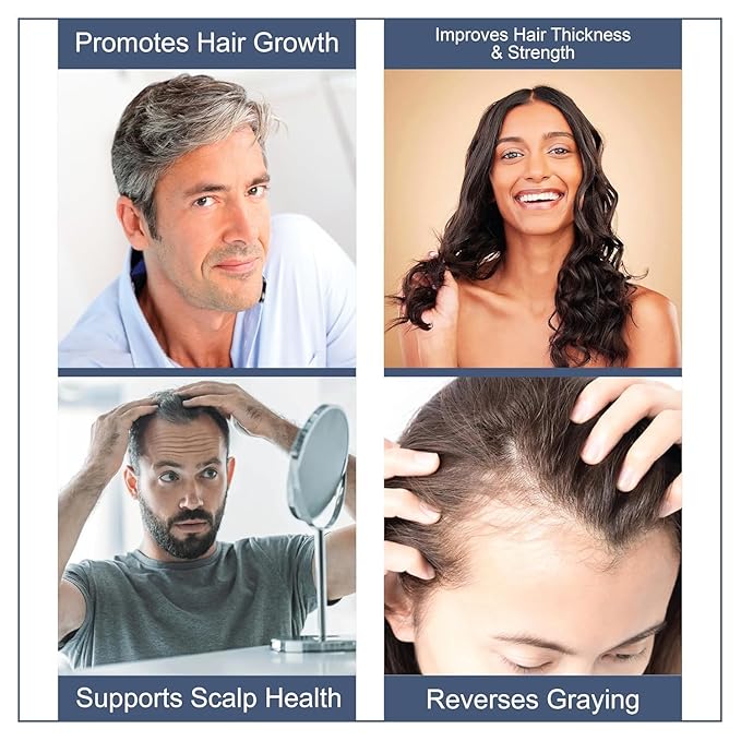 Hair Wellness Supplement | 360 Tablets – Pack of 3 | Daily Nutritional Support for Hair Strength, Thickness & Scalp Care | 17-in-1 Formula for Men & Women