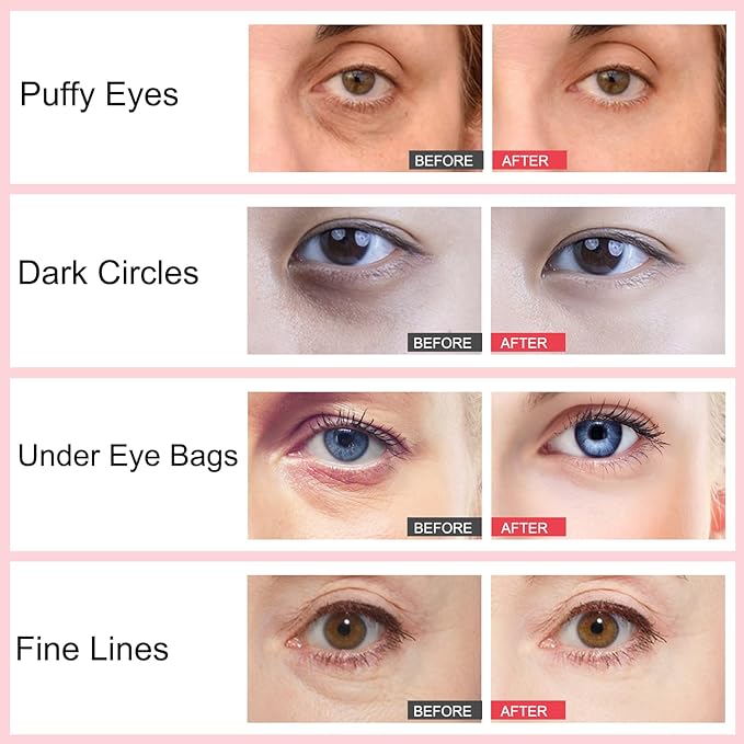 Retinol Eye Stick, Under Eye Cream Anti Aging Eye Brightener Stick, Retinol Brightening Eye Cream Retinol Eye Cream for Dark Circles and Puffiness, Wrinkles Hydrating Remove Eye Bags