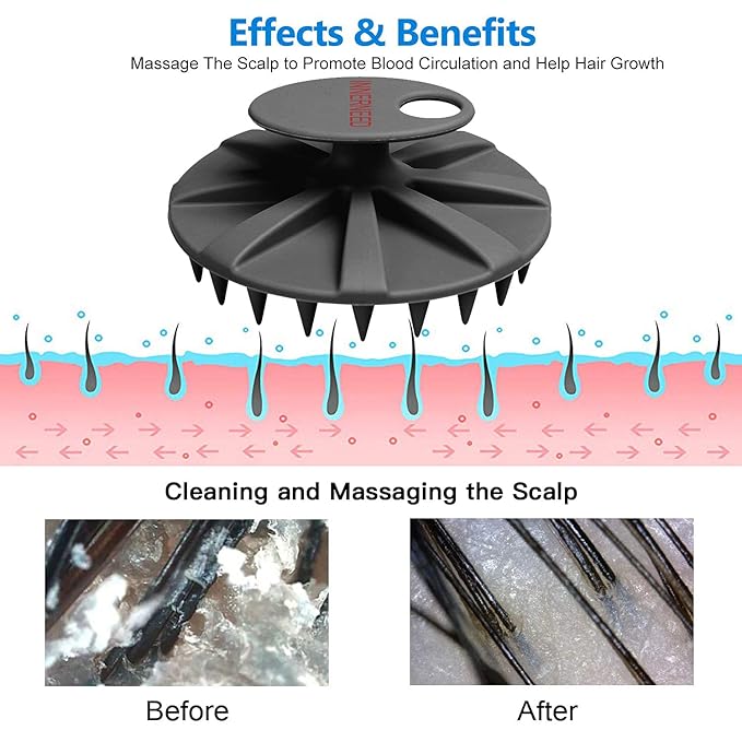 INNERNEED Scalp Massager Shampoo Brush, Wet & Dry Manual Scalp Care Head Scrubber Hair Washing, Soft Silicone Bristles, for Hair Growth, Dandruff Removal (Black+Gray)