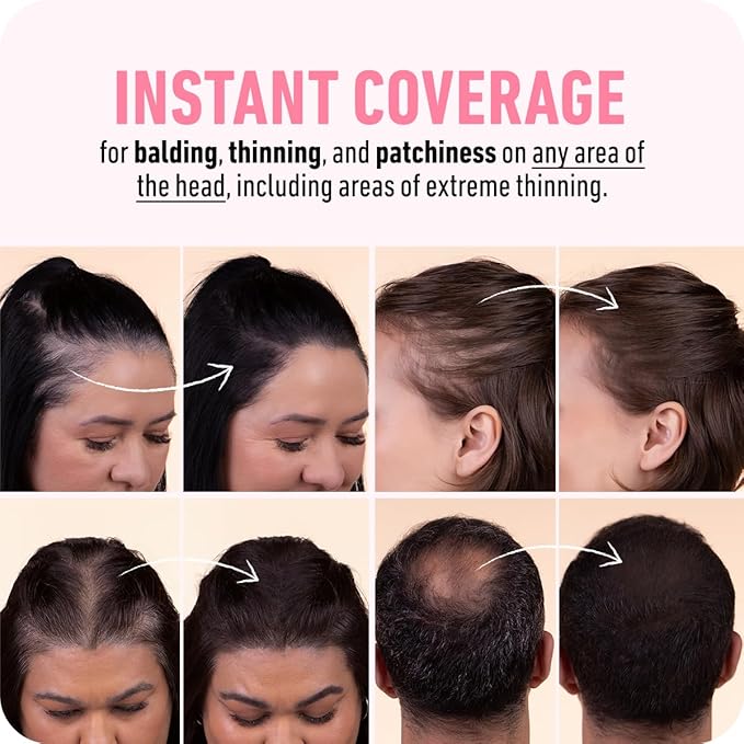 BOLDIFY Hairline Powder - Root Touch Up Hair Color for Gray Coverage - Bald Spot Concealing Hair Powder for Women & Men - 24-Hour Stain-Proof - Medium Brown