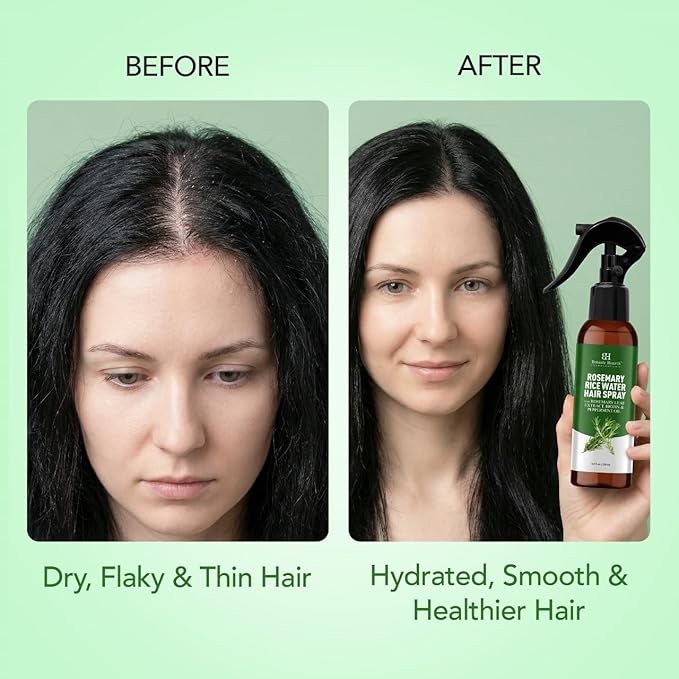 Botanic Hearth Rosemary Hair Growth Water Spray 6.8 fl oz, Korean Hair Care Oil for Scalp Detox, Hydration for Thinning Hair | Anti-Itch, Anti-Flake, Sulfate & Paraben Free