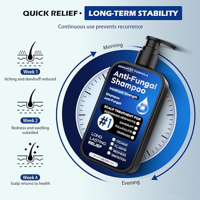 Antifungal Shampoo for Seborrheic Dermatitis, Folliculitis & Scalp Psoriasis, Anti-Dandruff Shampoo for Men & Women, Relieves Scalp Itching, Dryness, Sulfate & Paraben-Free, 10.1 Fl Oz-Fresh