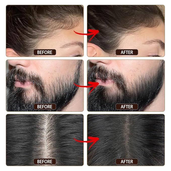 VOLLUCK Root Touch up Powder, Instant Hairline Powder for Thinning Areas and Gray Hair Coverage, Natural and Non-greasy Root Cover up for Women and Men (Brown, 0.35 Ounce)