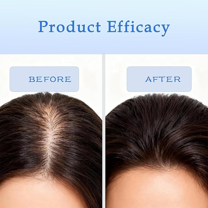 Rosemary Hair Growth Serum Roll On with 3% Rosemary，2% Ginger oil，3% Aloe Vera Extract， Stronger Root，stimulate follicle,Hair Thicker，Hair Loss Treatment.Advanced Hair Regrowth,0.85 Fl Oz pcs