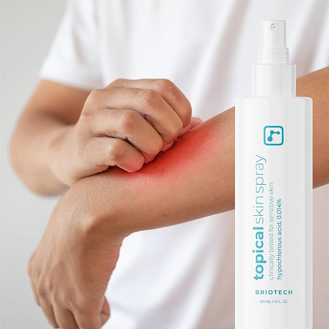BRIOTECH Topical Skin Spray, Hypochlorous Acid Spray for Sensitive Skin, HOCl Facial Mist, Full Body Support Against Irritation, Calm Redness, Soothe Foot & Scalp, 2 oz Travel Size (2 Pack)