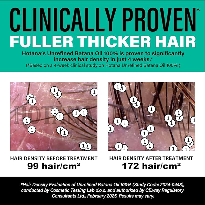 Unrefined Batana Oil for Hair Growth - Authentic & Organic Dr Sebi Batana Hair Mask from Honduras - Natural Hair Growth Oil - 4 Ounce Jar